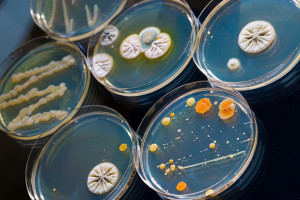 Petri dish with bacteria colonies